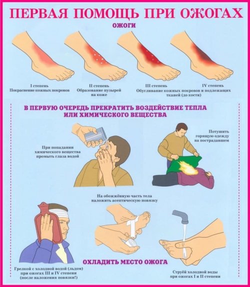 Первая помощь при ожогах