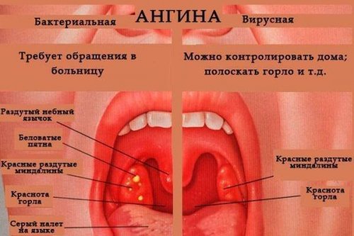 post 610b14de89a3d 500