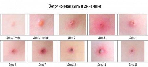 post 6145d8e242000 500
