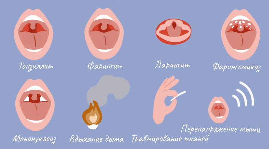 10 лучших леденцов для горла - Оториноларингология - Статьи - Поиск ...