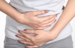 Гастроэнтерологи рекомендуют: лучшие препараты при синдроме раздраженного кишечника