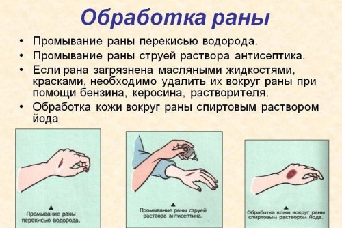 Правильная обработка раны