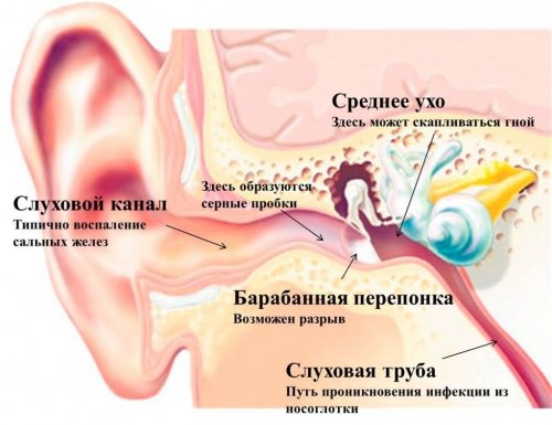 Что делать если сильно болит ухо внутри