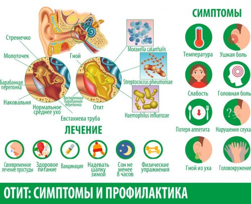 Симптомы отита