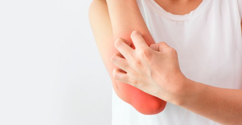 Лучшие средства от псориаза