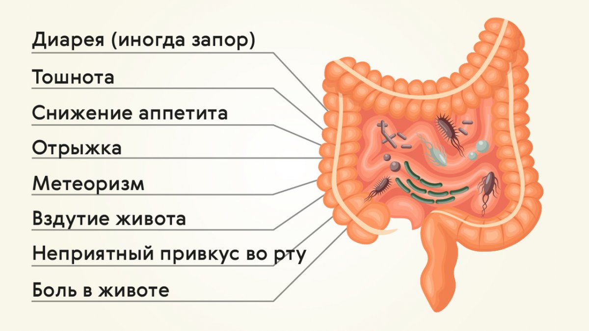 Чем лечить кишечник: 5 лучших препаратов - Гастроэнтерология ...