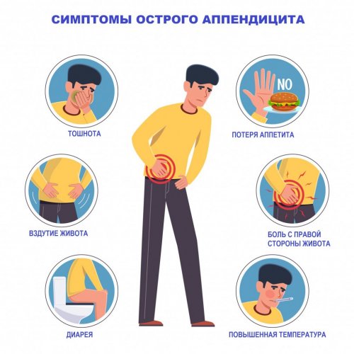Симптомы острого аппендицита