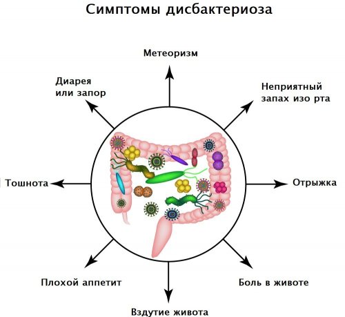 Симптомы нарушения микрофлоры кишечника