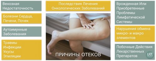 Причины отека ног