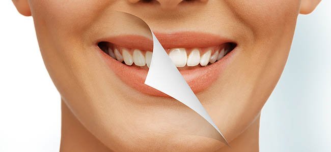 Чем отбелить зубы дома