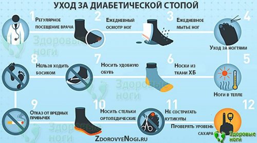 Как ухаживать за "диабетической стопой"