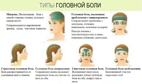 Виды головной боли