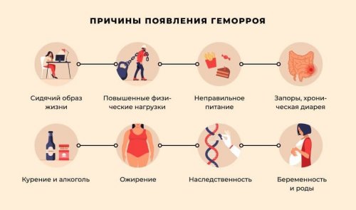 Причины геморроя