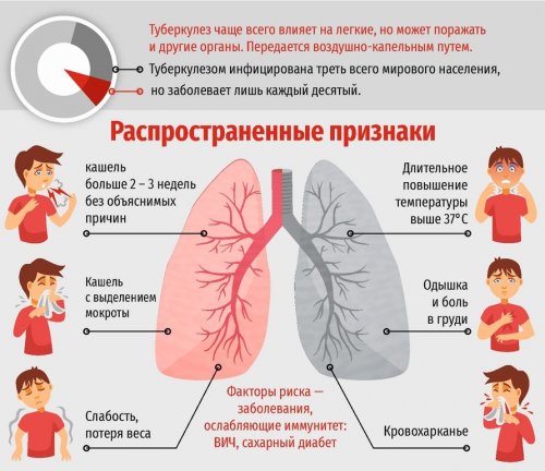 Симптомы туберкулеза