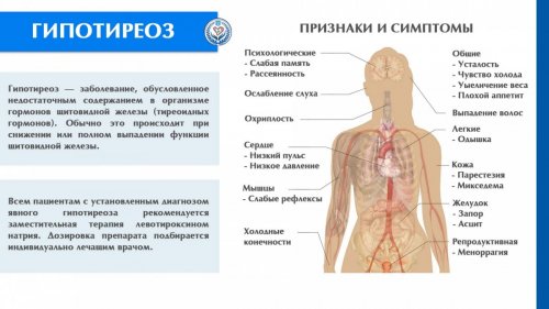 Симптомы гипотиреоза