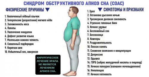 Синдром обструктивного апноэ сна