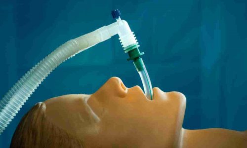 Эндотрахеальный наркоз