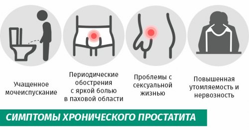 Симптомы простатита