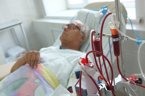 Гемодиализ: очищение крови при почечной недостаточности