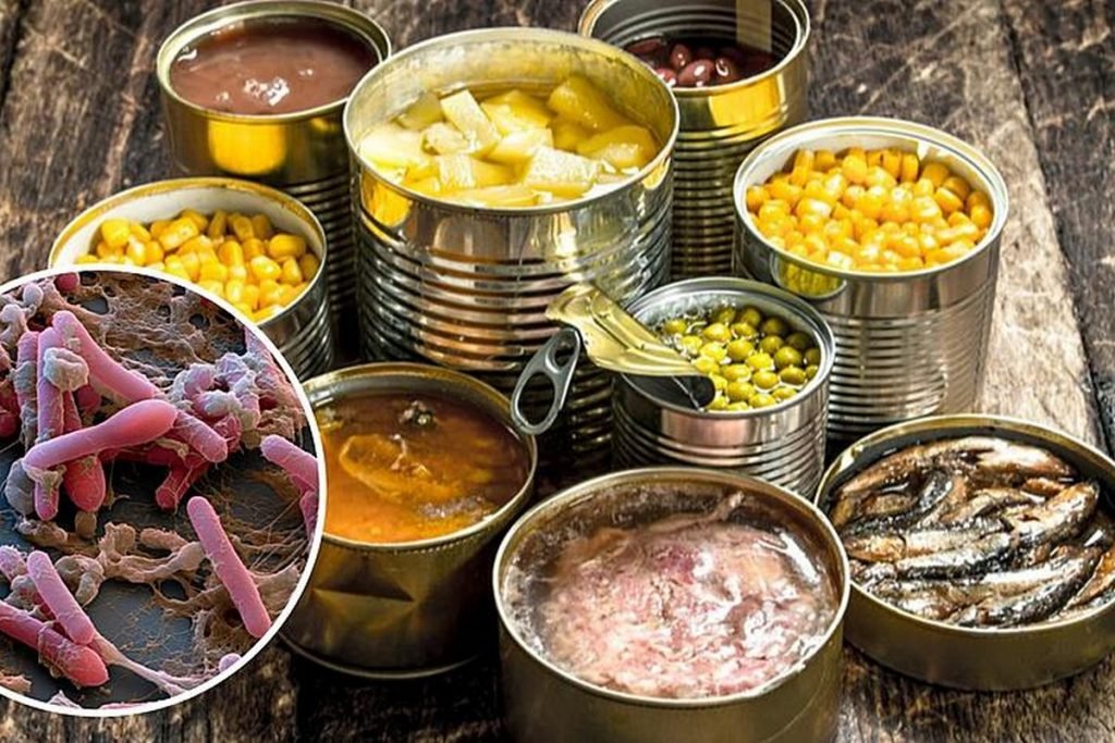 Ботулизм: симптомы, причины, лечение