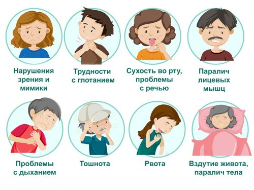 Симптомы ботулизма