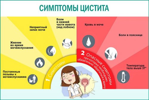 Симптомы цистита