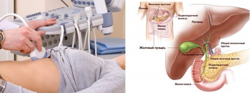 Практически каждый человек имеет какую-то деформацию желчного пузыря