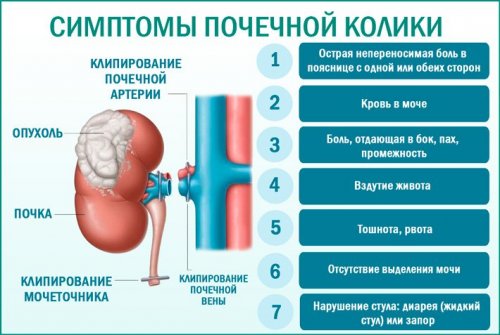 Почечная колика