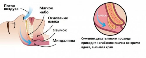 Как появляется храп