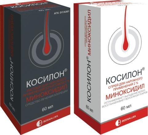 «Косилон» при выпадении волос: описание препарата