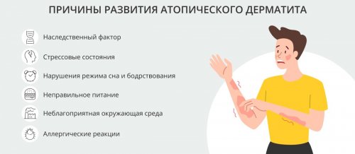 Причины атопического дерматита у взрослых