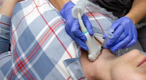 Биопсия узла щитовидной железы