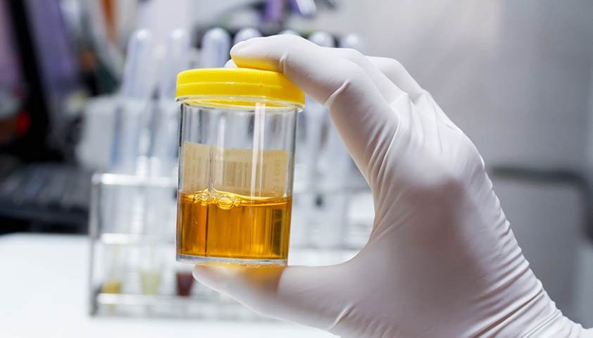 Лейкоциты в моче у женщин: причины и лечение