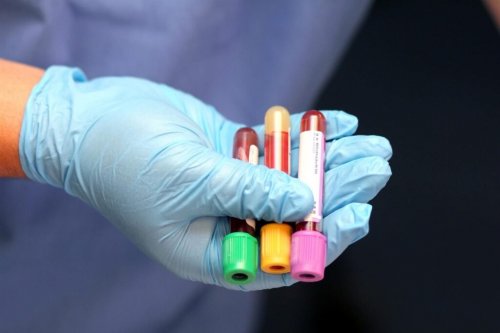 Нарушение электролитического баланса негативно сказывается на сердце