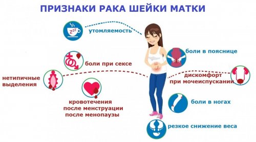 Симптомы рака шейки матки