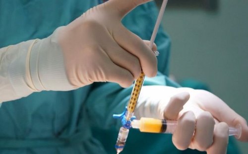 Что такое липофилинг и кому подойдет эта процедура