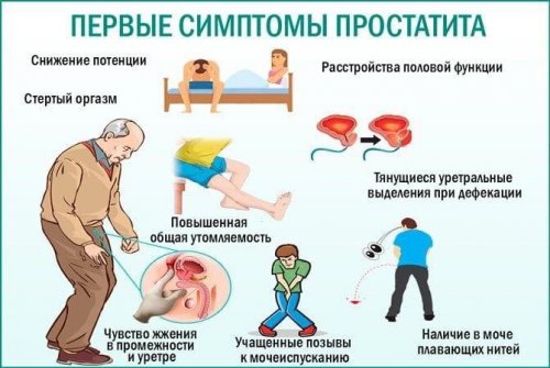 Как распознать простатит