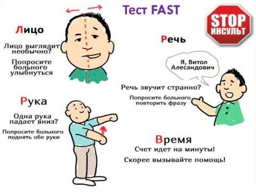 Тест на инсульт F.A.S.T.