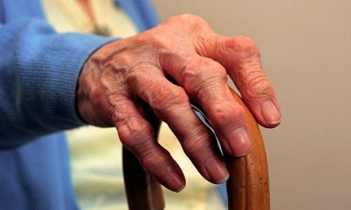 10 ранних симптомов ревматоидного артрита