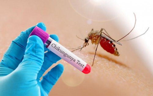 Европе угрожает тропический вирус, вызывающий мучительную боль в суставах