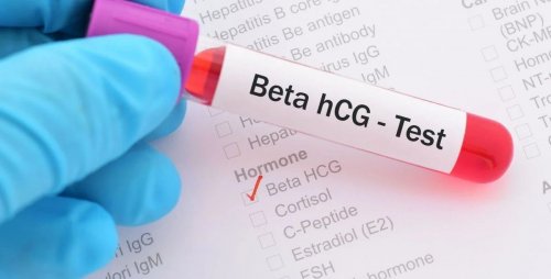 Что показывает ХГЧ и как правильно понять результат анализа