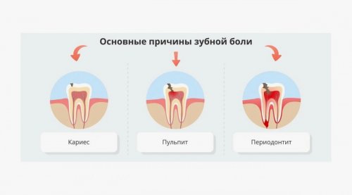 Почему болит зуб?