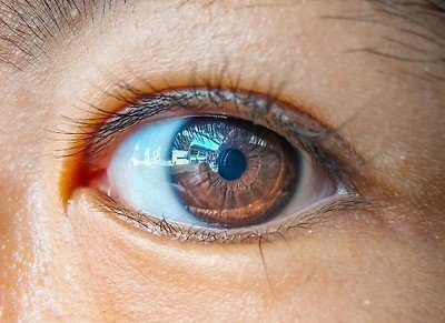 Вирус из морепродуктов вызвал загадочную болезнь глаз у 70 человек в Китае