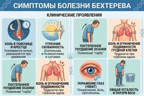 Симптомы болезни Бехтерева